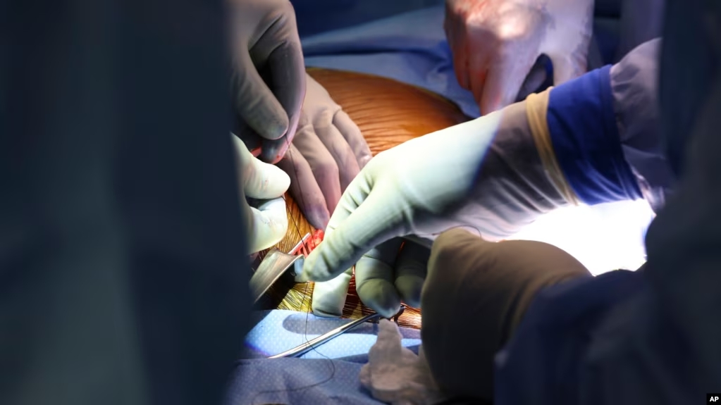 2024年3月16日，外科医生在波士顿麻省总医院进行了世界上首例转基因猪肾移植到活体人体中的手术。（美联社照片/麻省总医院提供）Surgeons perform the world’s first genetically modified pig kidney transplant into a living human, at Massachusetts General Hospital, in Boston, March 16, 2024. 
